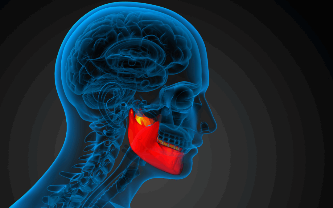 3D medical illustration of jaw and facial anatomy with highlighted inflammation, showing health impacts of jaw structure.
